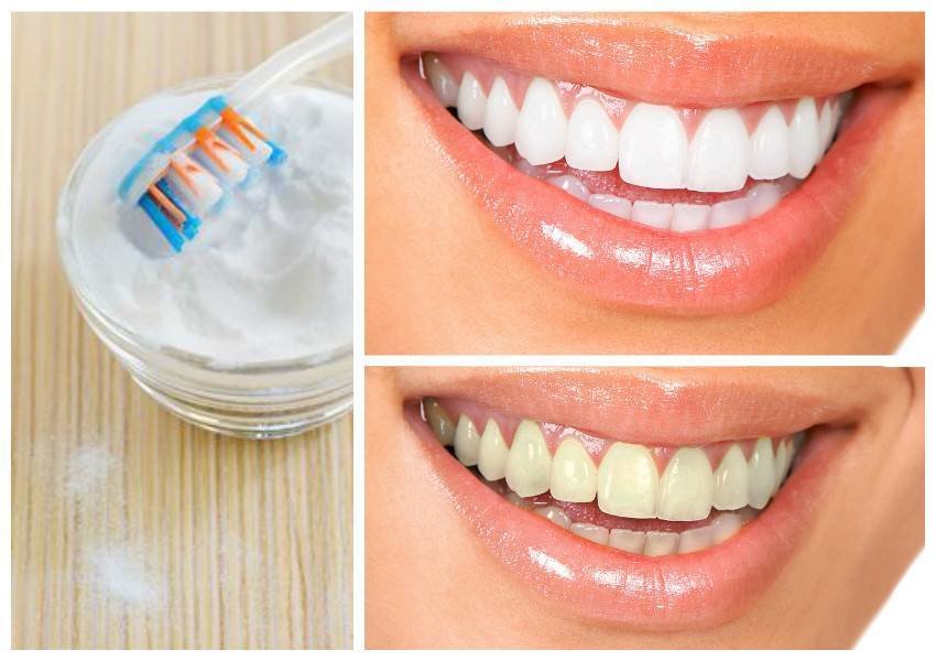 Алгоритм правильной чистки зубов