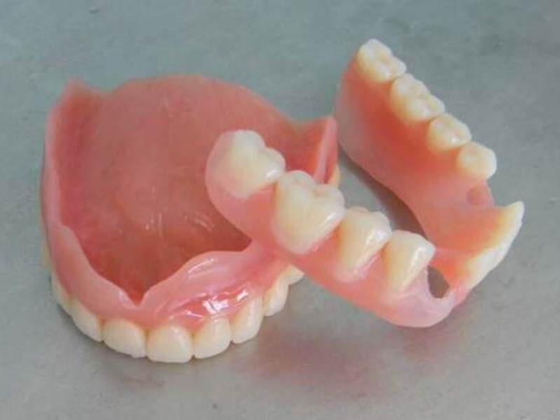 Как правильно, нужно ли снимать зубные съемные протезы на ночь? как носить зубные протезы? узнай здесь!