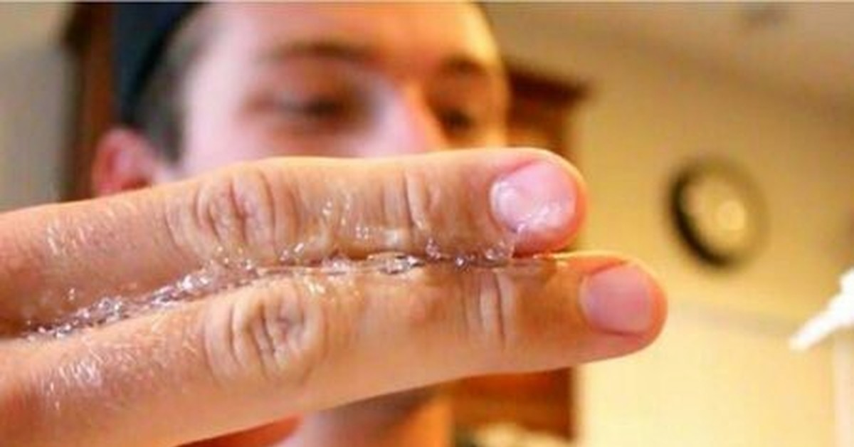 Чем оттереть супер клей с поверхности кожи и пальцев рук за пять минут?