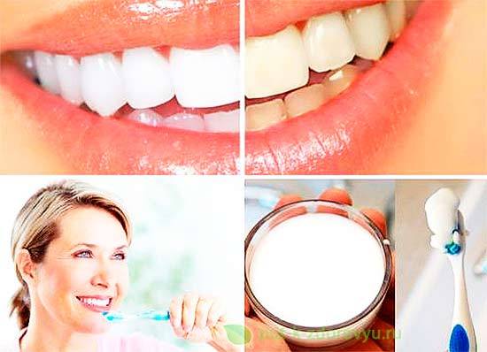 Как отбелить зубы содой: способы, рецепты и особенности