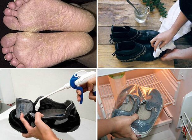 Обработка обуви от грибка: лучшие средства и отзывы