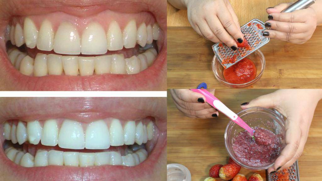 Можно ли чистить зубы содой? как правильно чистить зубы содой