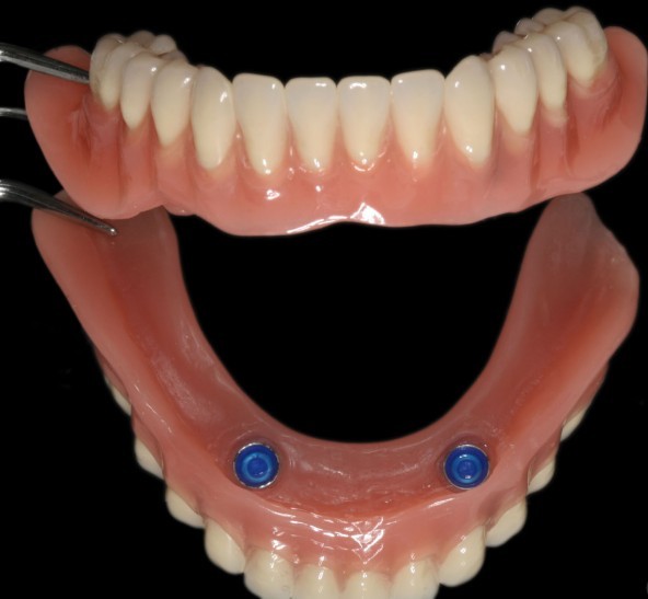 Учимся правильно хранить съёмные зубные протезы