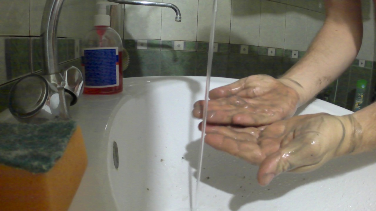 7 проверенных способов, чем быстро отмыть йод с кожи рук.