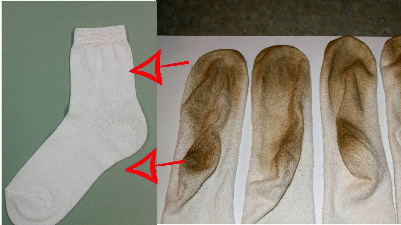 Белые носки как отстирать в домашних условиях?