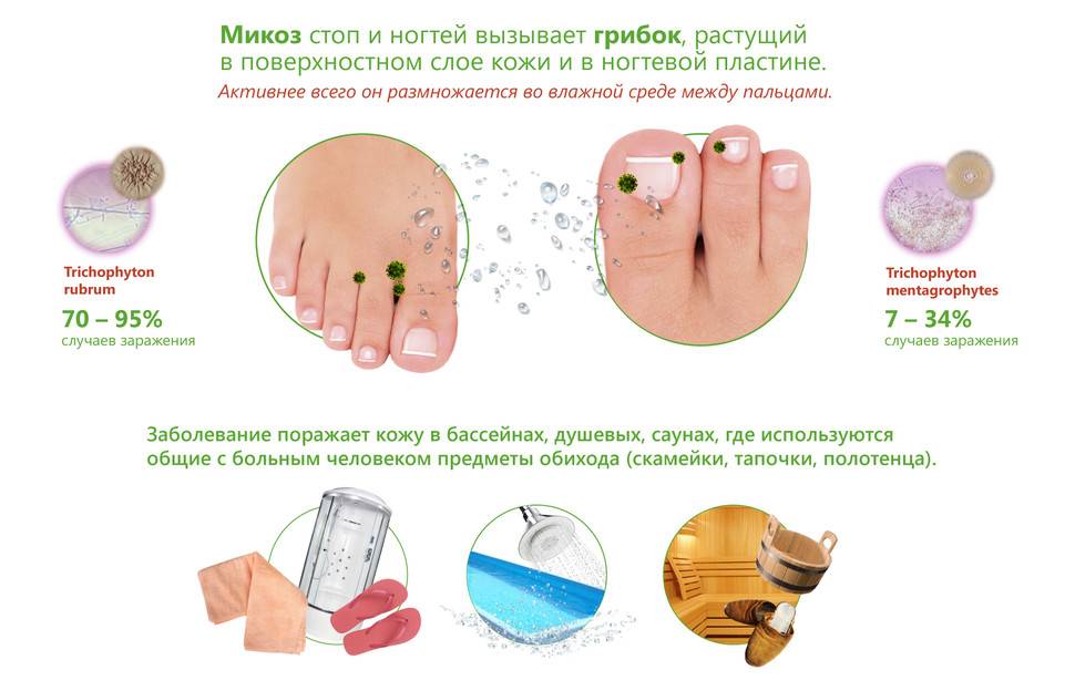 Как стирать носки при грибке ногтей и стопы: правила стирки вручную и в стиральной машине, рекомендации докторов